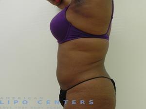 americanlipocenters_94.jpg
